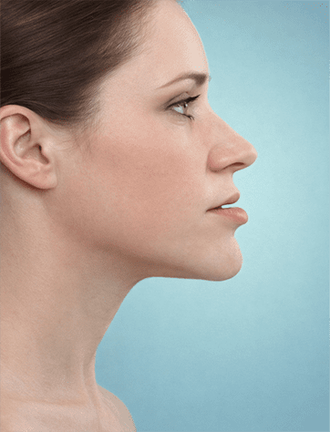 Cirurgia Ortognática Classe 3